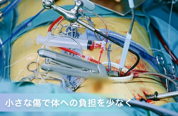 小さな傷で体への負担を少なく